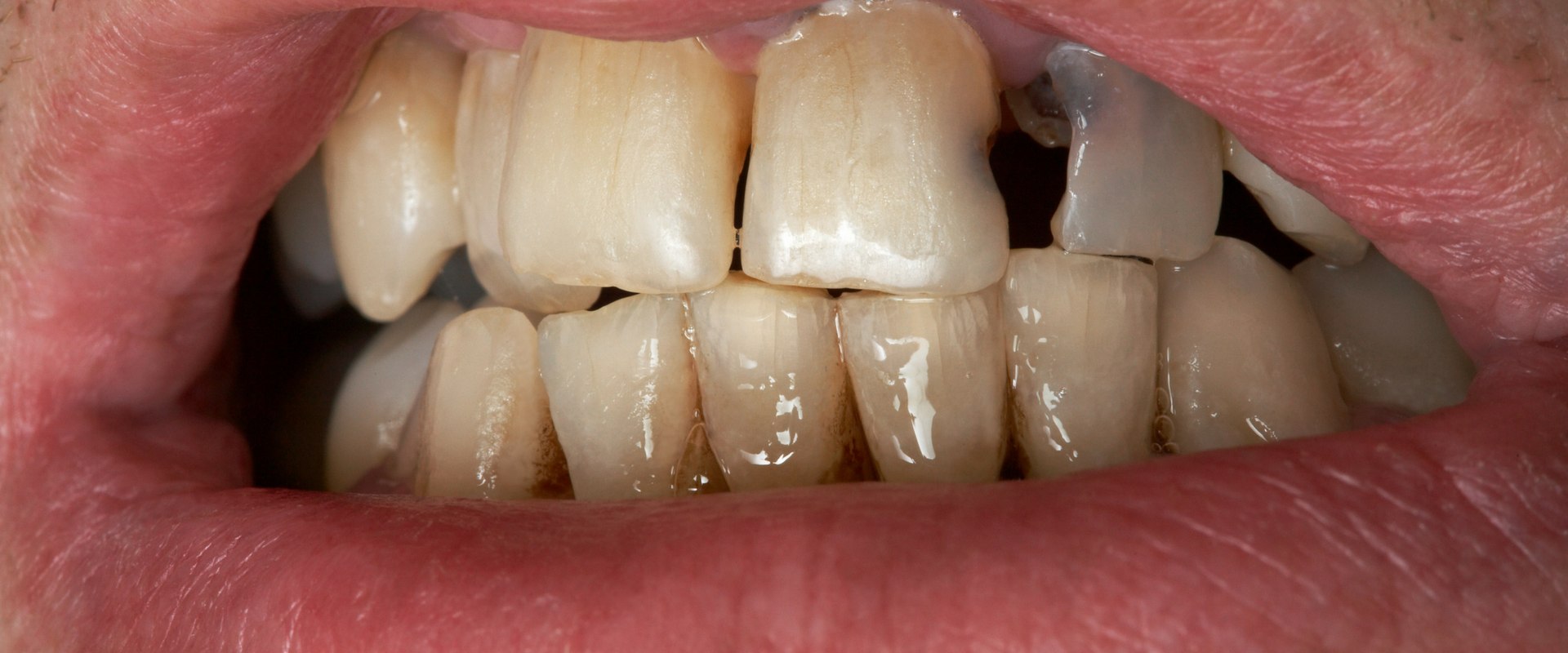 can-poor-dental-health-make-you-sick